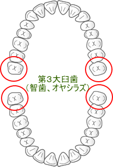 歯の本数と親知らず 歯の本数と親知らず